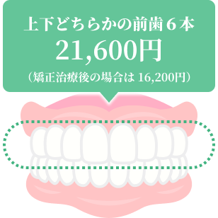 上下どちらかの前歯６本 21,600円