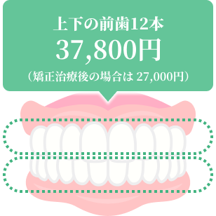 上下の前歯12本 37,800円